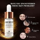 ARTISCARE 24K Gold Peptides Face Serum 20ml – Anti-Aging & Hydrating with Hyaluronic Acid