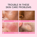 Masque facial à la boue de cerisier Laikou, comprimés purifiants, hydratants et nettoyants pour les pores, réduisant les points noirs et l'acné. Soin de la peau (5/10 unités).