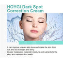 Powerful Spot-removing Whiten Cream Brighten Skin Fast Eliminates Melanin Pigmentation Melasma Dark Spots Moisturize Beauty Gel