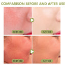 Stick solaire mat SPF 50+ – Crème solaire visage et corps | Protection UV résistante à l'eau | Crème solaire hydratante sans huile