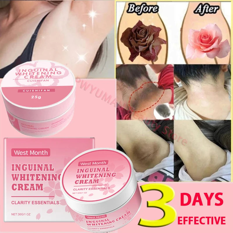 Body Whitening Niacinamide Brighten Cream For Intimate Parts Underarm Bleach Knees Lighten Thigh Inner Korean Skin Care Products