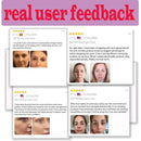 5 In 1 Face Serum 30% Vitamin C Moisturizing brightening Vitamin C Hyaluronic Acid Facial Serum Shrink Pores Skin Care