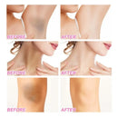 Body Whitening Niacinamide Brighten Cream For Intimate Parts Underarm Bleach Knees Lighten Thigh Inner Korean Skin Care Products