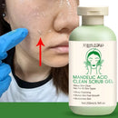 Gel exfoliante facial: limpiador profundo de poros, hidratante y blanqueador.