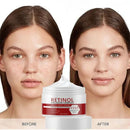 Crème éclaircissante visage et corps 3 en 1 au rétinol, collagène et acide hyaluronique. Élimine les taches brunes, la mélanine, l'acné et éclaircit le teint.