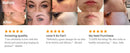 Máquina facial profesional de alta frecuencia, varita de electroterapia, varitas de argón y neón de vidrio, elimina arrugas, inflamación, acné y piel.