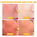Matte Finish SPF 50+ Loose Powder | Sunscreen + Oil Control for Face