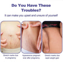 Stretch Mark Vanishing Cream Remove Body Buttock Breast Marks Effective Repair Maternity Loose Firming Skin Care
