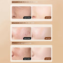 Whiten and Lighten Spots Mask Spots Peel-Off Facial Mask Anti-Blemish Freckle Brightening Mask Deeply Clean Pore Tightening Mois