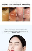 RUYI Niacinamide Face Mask Hydrating Moisturizing Whitening Improves Dullness Anti-Dryness Skin Nourishment Winter skincare
