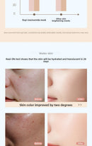 RUYI Niacinamide Face Mask Hydrating Moisturizing Whitening Improves Dullness Anti-Dryness Skin Nourishment Winter skincare