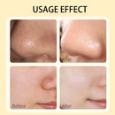 Turmeric  Clay Mask Deep Cleansing Facial Improves Dark Spots Acne Hydrating Skin Care Tightens Skin Evens Skin Tone